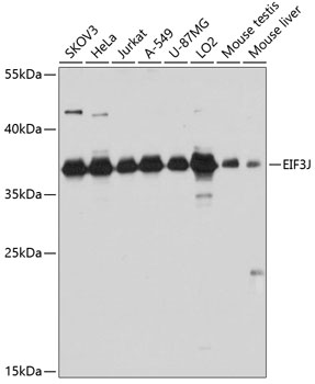 EIF3J Polyclonal Antibody (E-AB-65594)