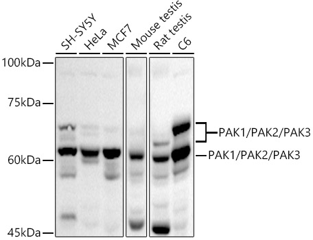 PAK1/PAK2/PAK3 Polyclonal Antibody (E-AB-92329)
