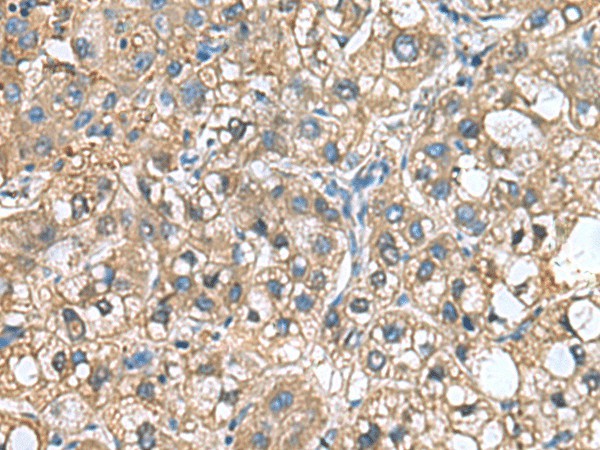 IGLL1 Polyclonal Antibody (E-AB-19173)