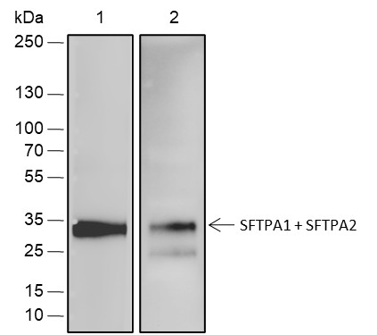 Recombinant SFTPA1+SFTPA2 Monoclonal Antibody (AN301822L)