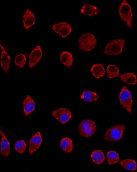 DAO Polyclonal Antibody (E-AB-60889)