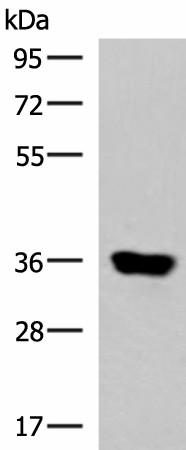 KCNK15 Polyclonal Antibody (E-AB-18167)