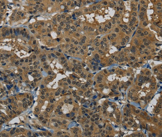 PNN Polyclonal Antibody (E-AB-16715)