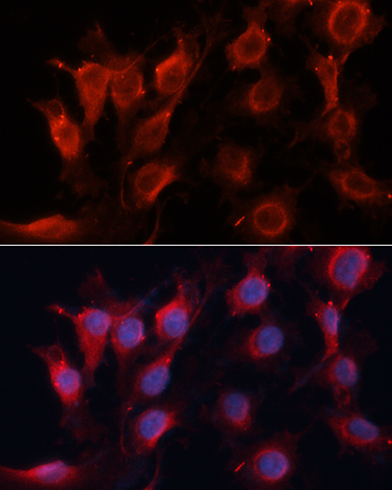 VEGF Polyclonal Antibody (E-AB-64131)