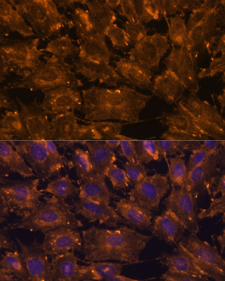 SCGB3A2 Polyclonal Antibody (E-AB-66012)