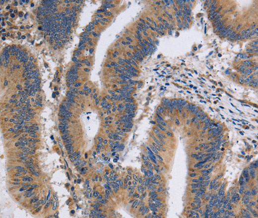 ITPR1 Polyclonal Antibody (E-AB-13344)