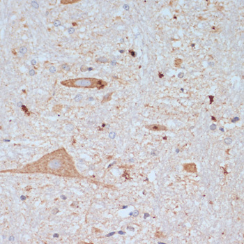 SLC18A3 Polyclonal Antibody (E-AB-68321)