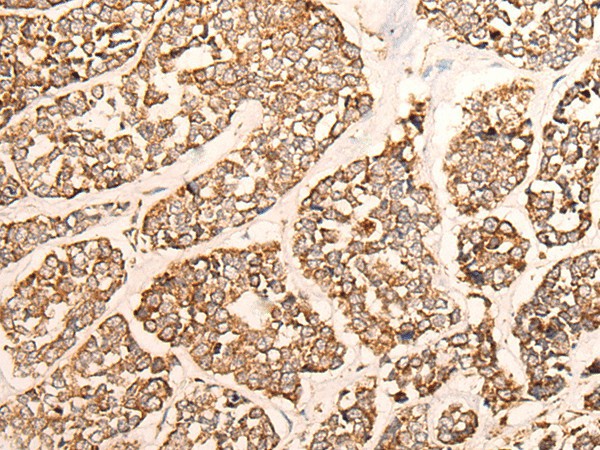 GRIA4 Polyclonal Antibody (E-AB-53406)