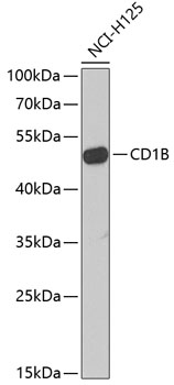 CD1B Polyclonal Antibody (E-AB-62654)