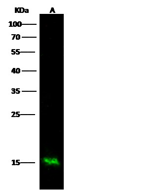 Recombinant S100A9 Monoclonal Antibody (AN300081P)