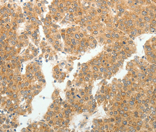 GEMIN2 Polyclonal Antibody (E-AB-15852)