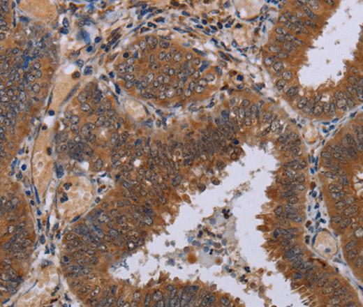 NPTX1 Polyclonal Antibody (E-AB-13468)