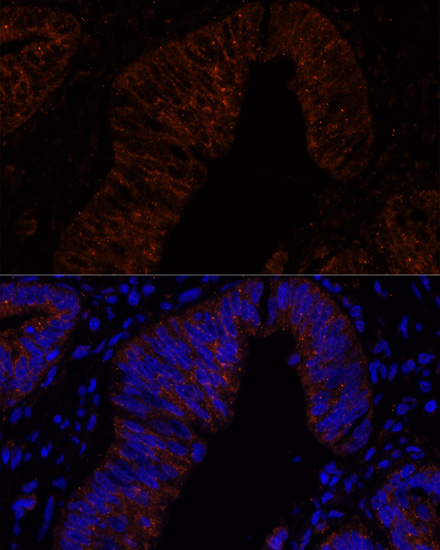 MUC2 Polyclonal Antibody (E-AB-66323)