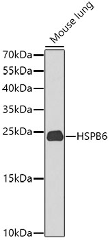 HSPB6 Polyclonal Antibody (E-AB-63205)
