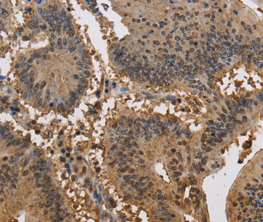 JAG2 Polyclonal Antibody (E-AB-13348)