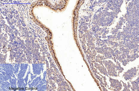 COL1A1 Monoclonal Antibody (E-AB-22152)