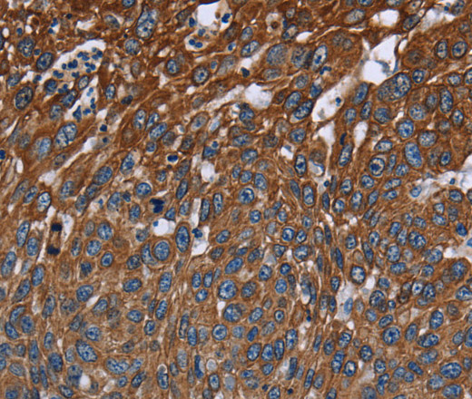 FCGR3A Polyclonal Antibody (E-AB-11321)
