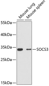 SOCS3 Polyclonal Antibody (E-AB-63265)