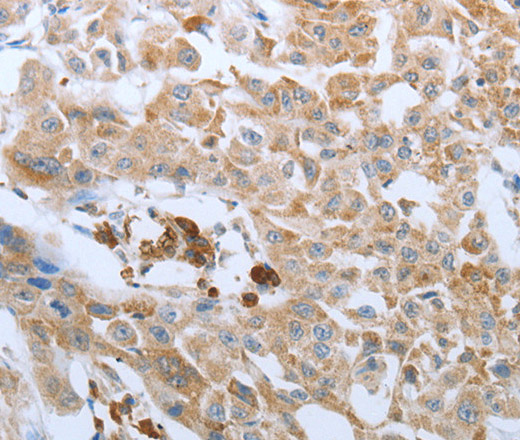 FGF1 Polyclonal Antibody (E-AB-12293)