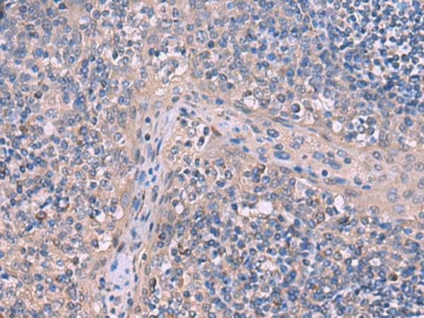 ITPR2 Polyclonal Antibody (E-AB-18139)