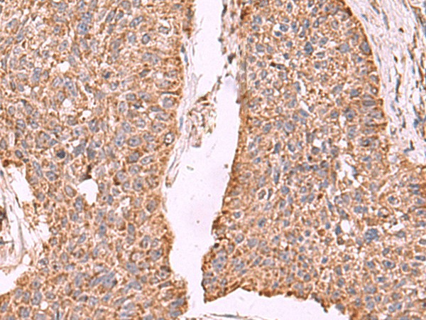 PER3 Polyclonal Antibody (E-AB-19010)