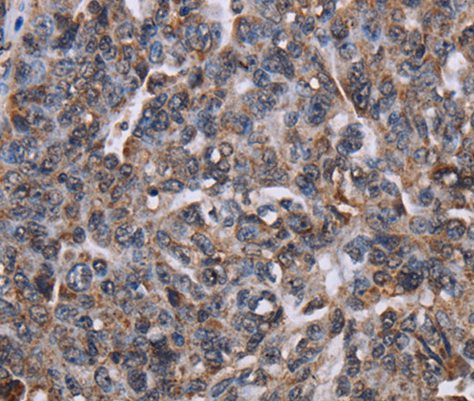 LDOC1 Polyclonal Antibody (E-AB-15168)