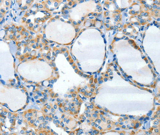 HID1 Polyclonal Antibody (E-AB-13164)