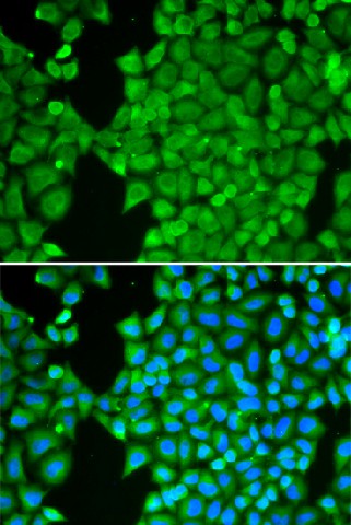 CA3 Polyclonal Antibody (E-AB-64660)