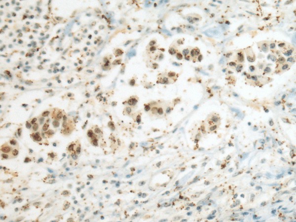SEPHS1 Polyclonal Antibody (E-AB-19267)
