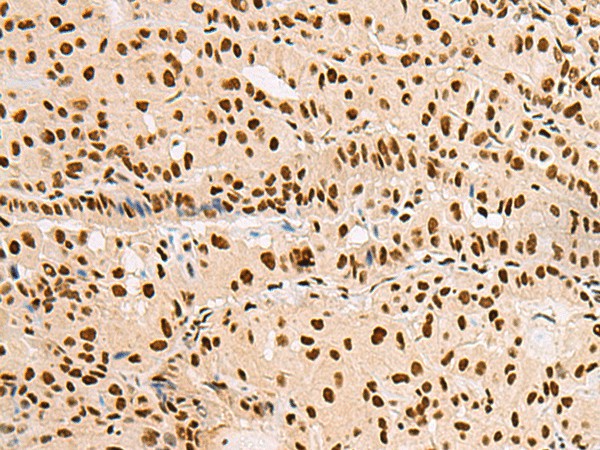XRCC4 Polyclonal Antibody (E-AB-18317)