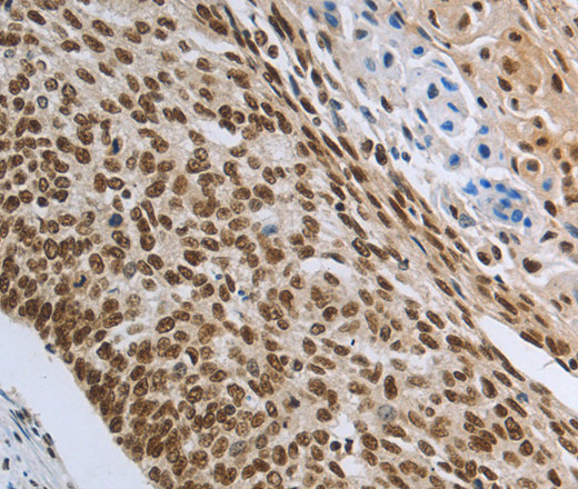PRMT3 Polyclonal Antibody (E-AB-15829)