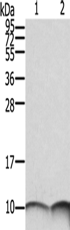 S100A6 Polyclonal Antibody (E-AB-15371)