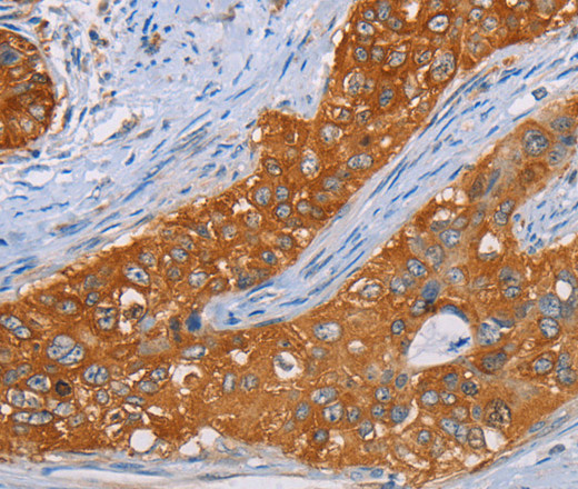 MMP1 Polyclonal Antibody (E-AB-10061)