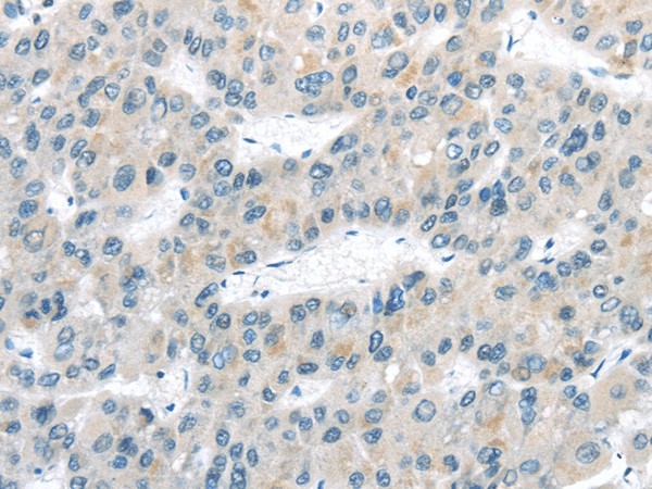 VLDLR Polyclonal Antibody (E-AB-17551)