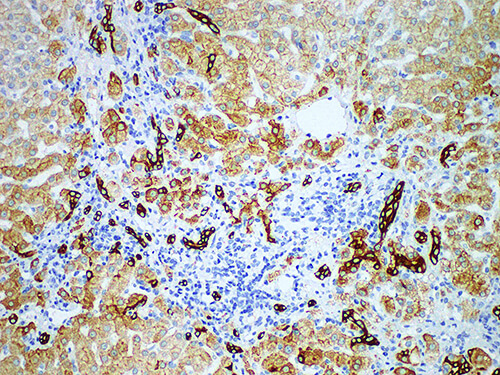 CK8（35betaH11） Monoclonal Antibody (ELAB6629-M)