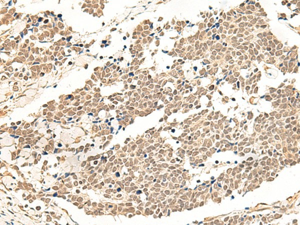 GPR139 Polyclonal Antibody (E-AB-18037)
