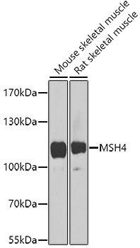 MSH4 Polyclonal Antibody (E-AB-68424)