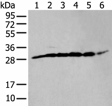 ETFB Polyclonal Antibody (E-AB-19544)