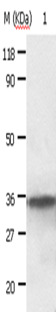 ANXA2 Polyclonal Antibody (E-AB-10043)