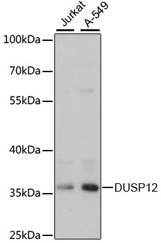 DUSP12 Polyclonal Antibody (E-AB-66033)