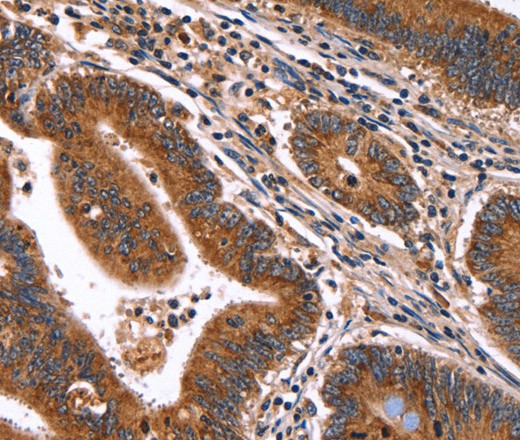 HACE1 Polyclonal Antibody (E-AB-16474)