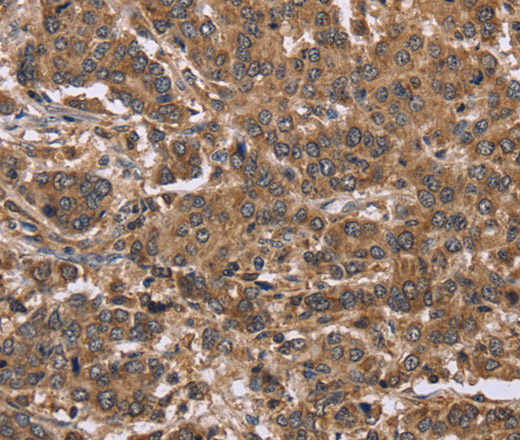 FABP6 Polyclonal Antibody (E-AB-15007)