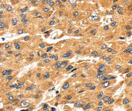 SH3KBP1 Polyclonal Antibody (E-AB-11578)