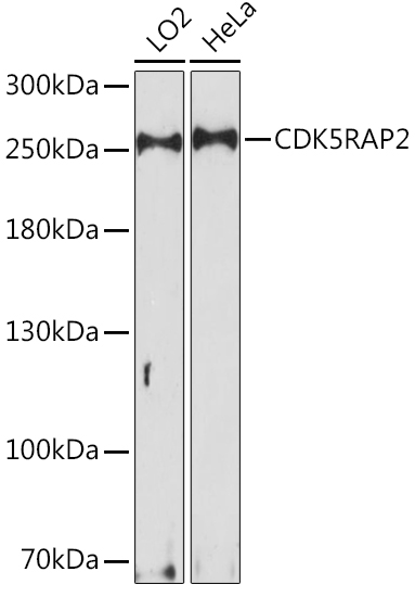 CDK5RAP2 Polyclonal Antibody (E-AB-91173)