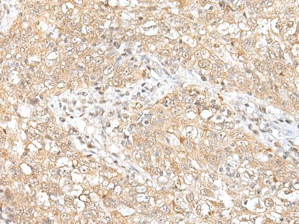 CHRNB2 Polyclonal Antibody (E-AB-53423)