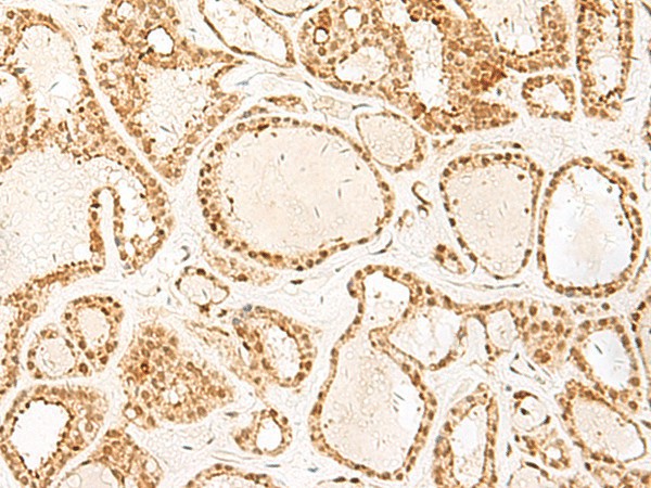 PSPC1 Polyclonal Antibody (E-AB-52739)