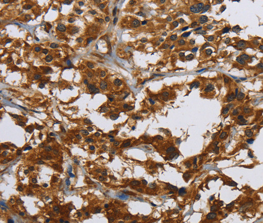 Claudin 2 Polyclonal Antibody (E-AB-15675)