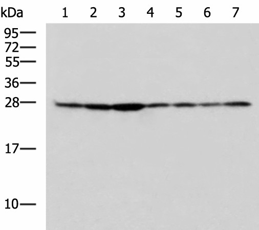 RPL10A Polyclonal Antibody (E-AB-53094)