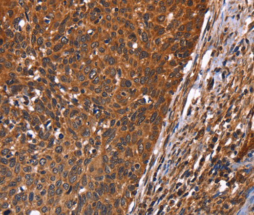 GUK1 Polyclonal Antibody (E-AB-13285)