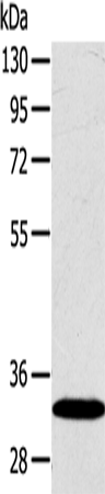 SULT2A1 Polyclonal Antibody (E-AB-15424)